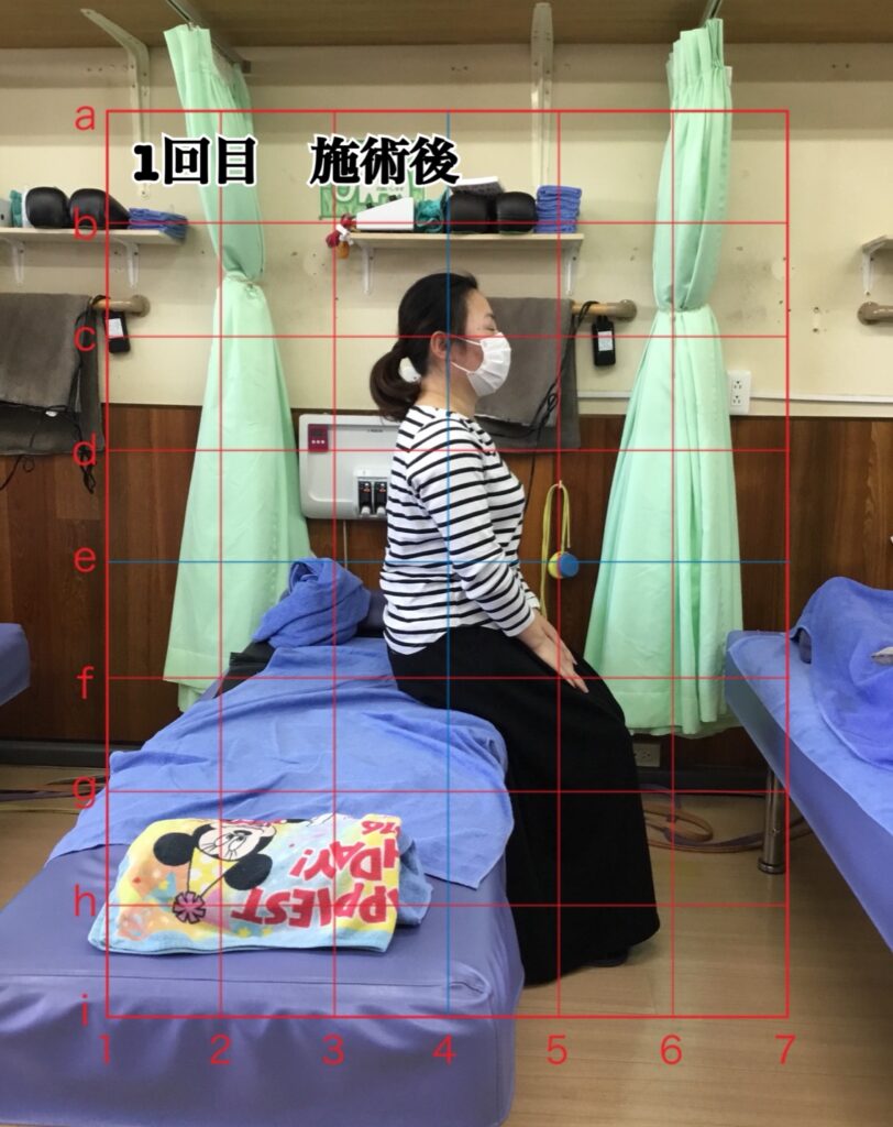 姿勢矯正コース1回目の施術後の姿勢(座位)