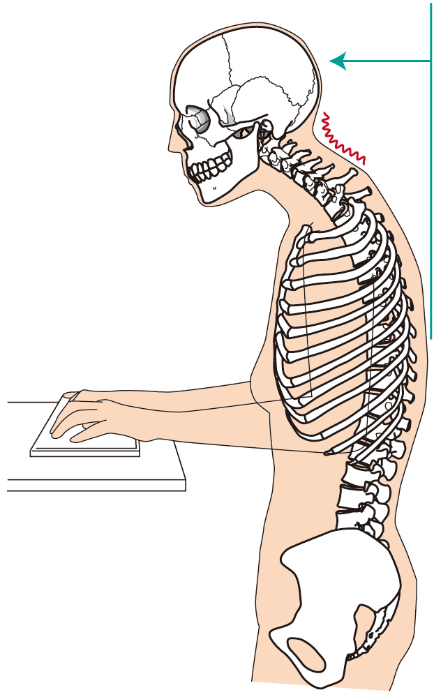 デスクワーク時によく見る姿勢（首が前に出ている）イラスト