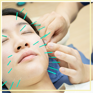 美容鍼