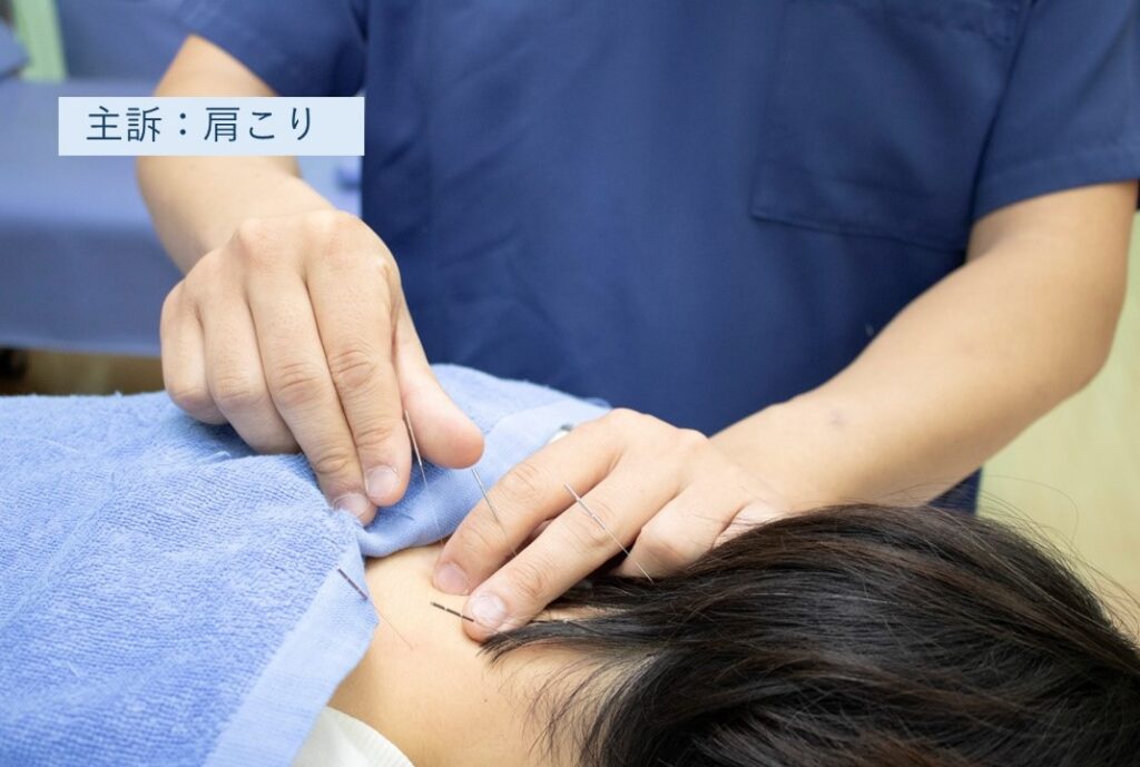 主訴:肩こりの施術