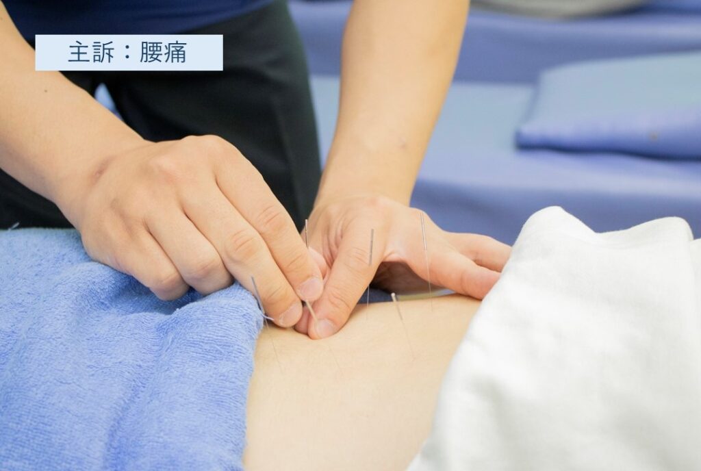 主訴:腰痛の施術